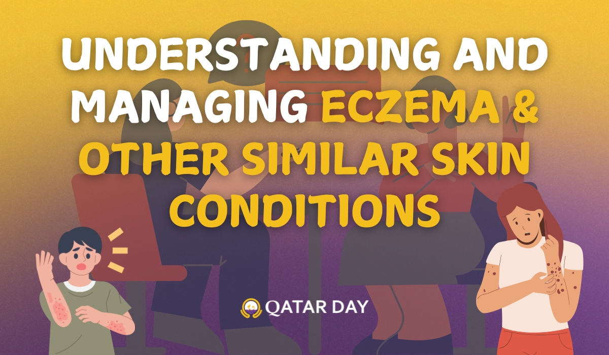 Understanding and Managing Eczema in Qatar’s Unique Climate